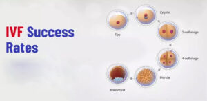 درصد موفقیت IVF