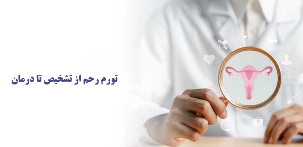 تورم رحم