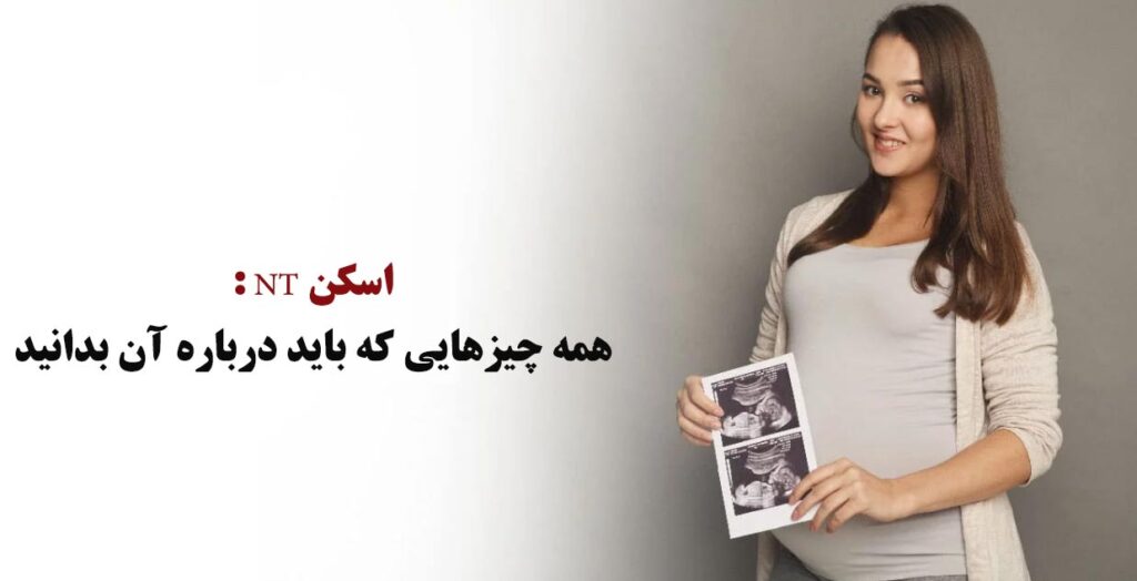 اسکن NT