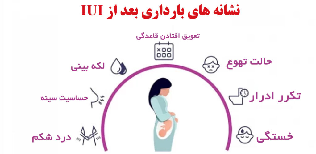 IUI