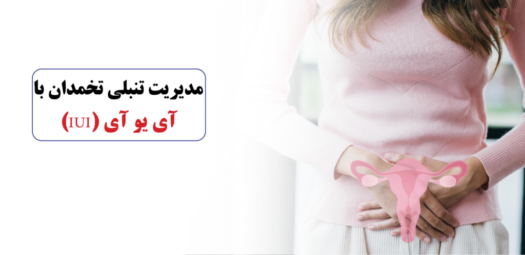 تنبلی تخمدان