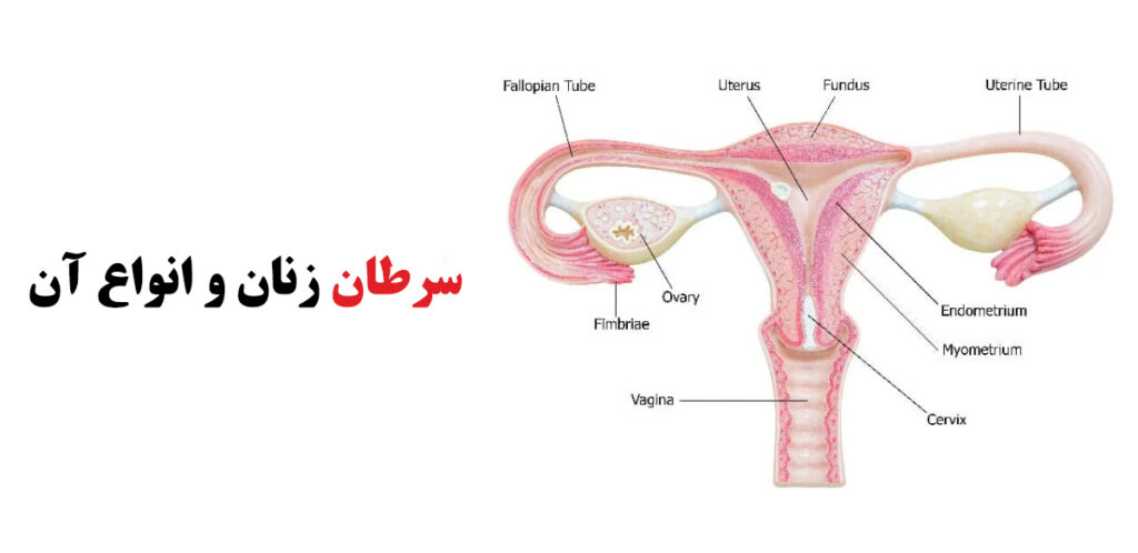 سرطان زنان
