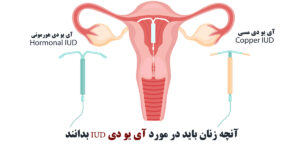 آی یو دی
