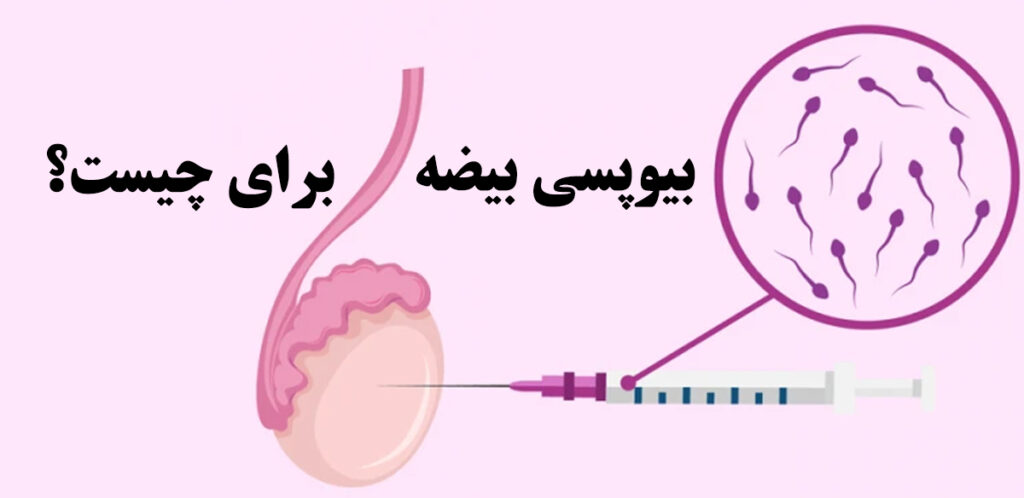 بیوپسی بیضه