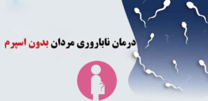 اسپرم
