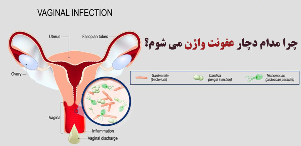عفونت واژن
