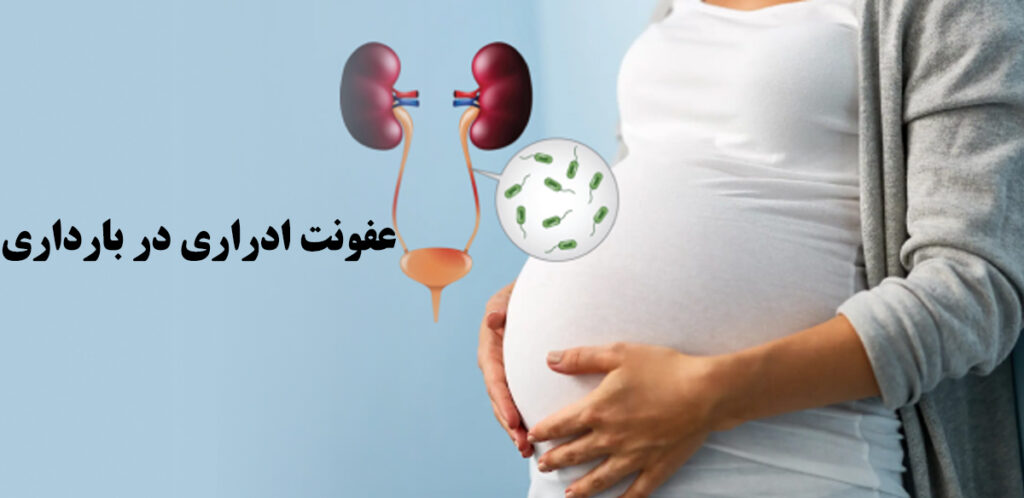 عفونت ادراری