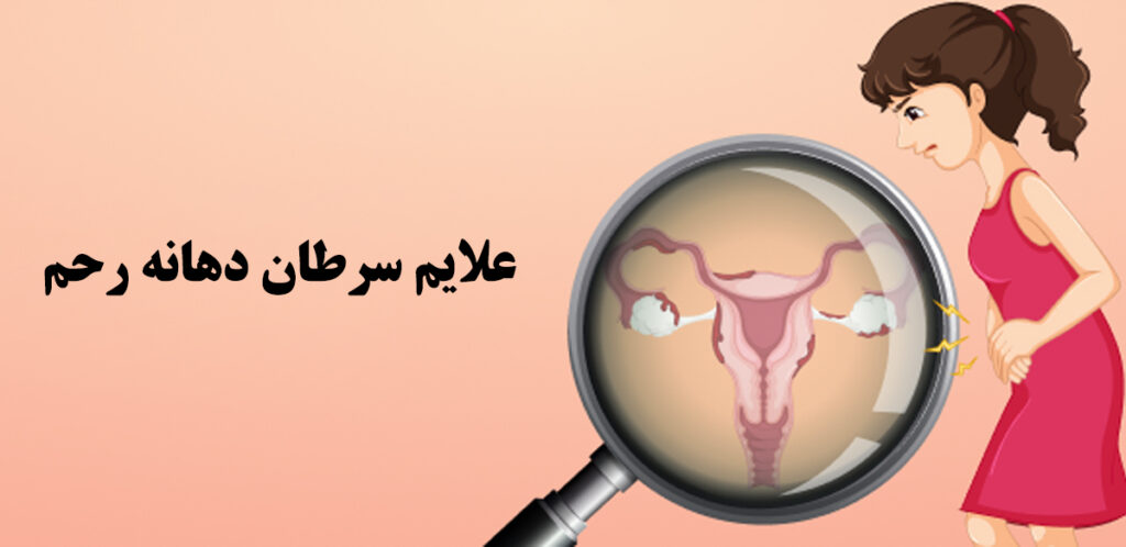 سرطان دهانه رحم