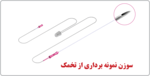 سوزن نمونه برداری از تخمک