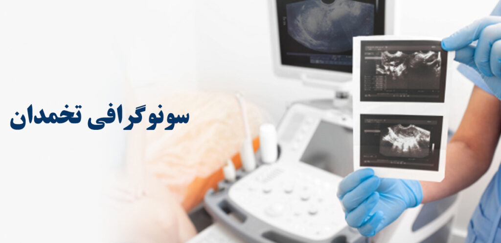 سونوگرافی تخمدان