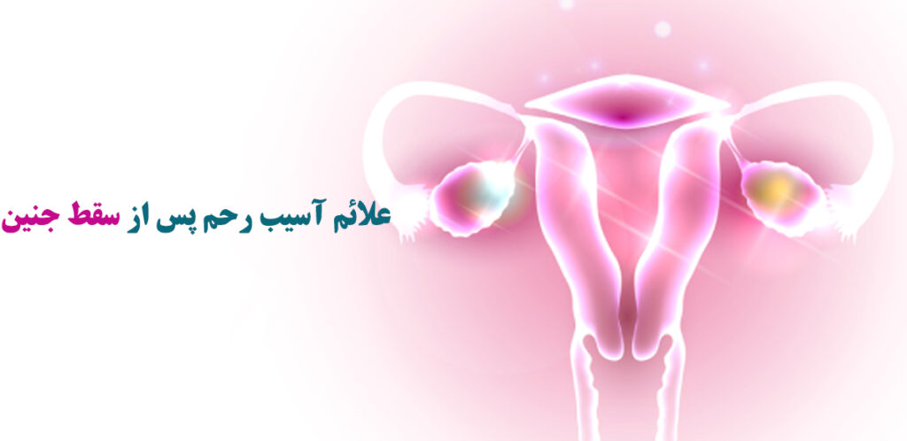 سقط جنین