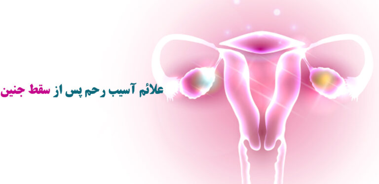 سقط جنین