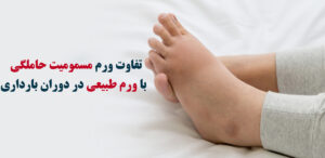 مسمومیت حاملگی