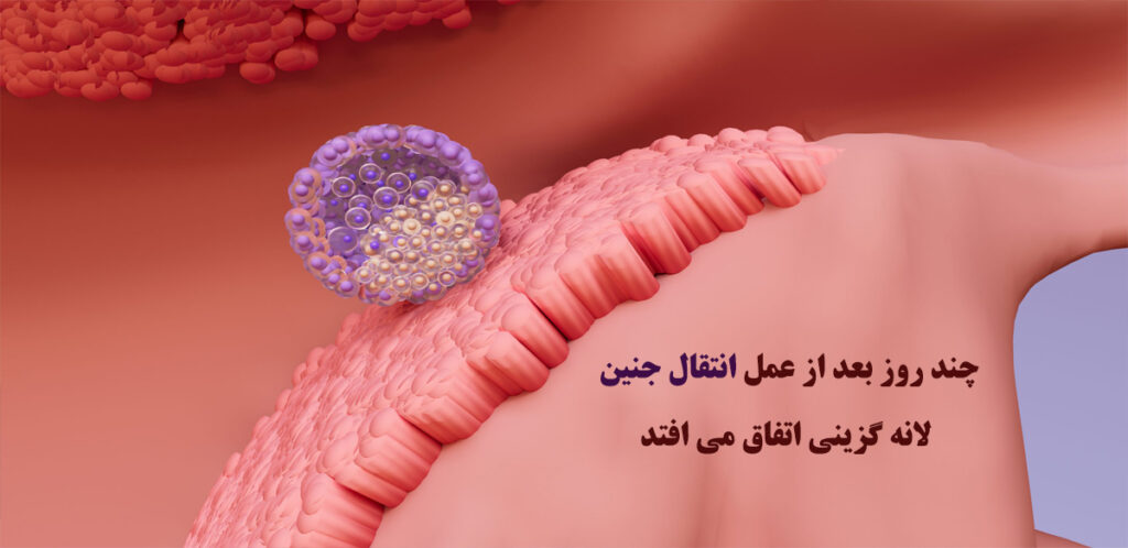 لانه گزینی