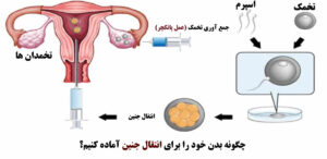 انتقال جنین