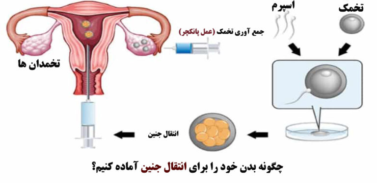 انتقال جنین
