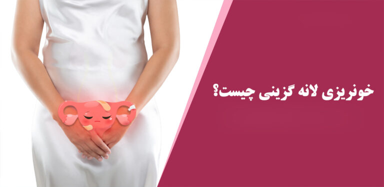 لانه-گزینی