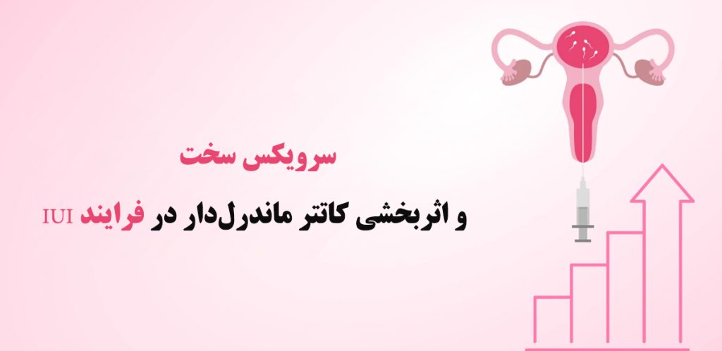 سرویکس