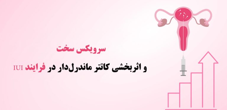 سرویکس