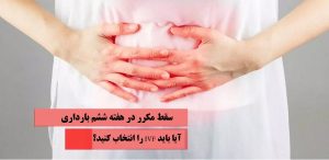 سقط جنین