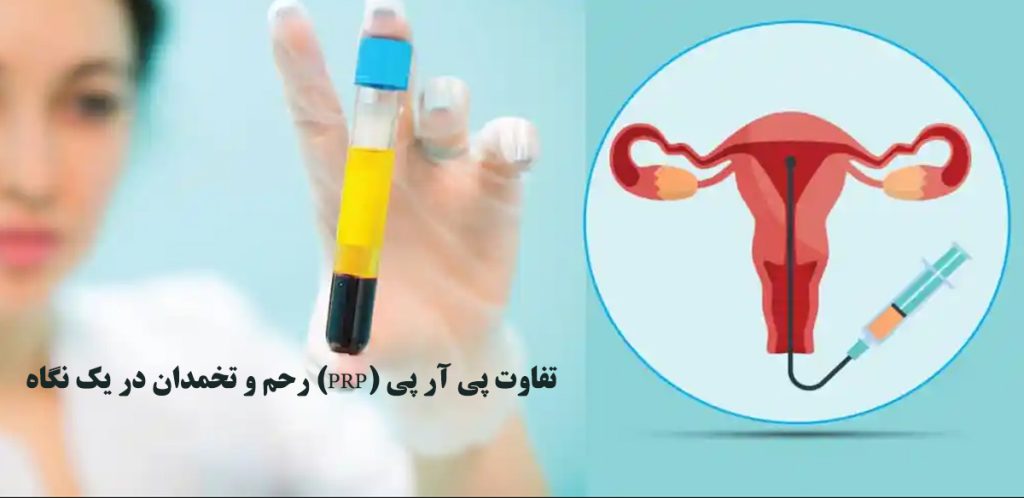 پی آر پی