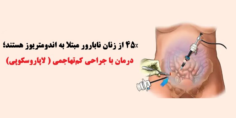 اندومتریوز